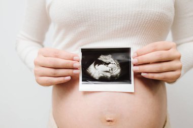 Anneliğin değerli anlarını ultrasonla kaydediyorum. Hamile bir kadın karnında bebeğinin ultrason fotoğrafını taşıyor.