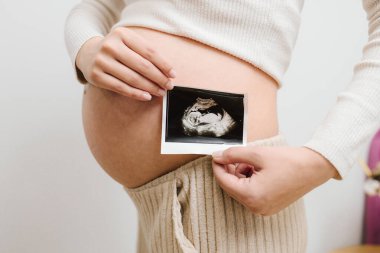 Hamileyken karnında doğmamış bebeğin ultrason resmi var. Mutlu anne sonogramdan sonra cenin ultrason görüntüsü gösterir.