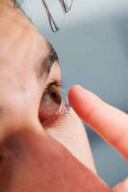 Göz teması lensleriyle göz doktorunun seçtiği görüş düzeltmesi. Adam görüş düzeltmesi için günlük kontak lens takıyor.