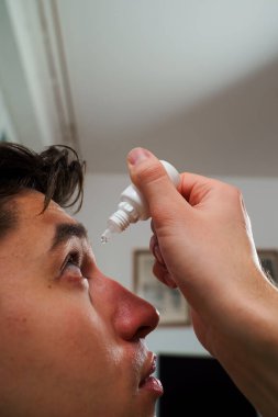 Evde göz damlası ile göz tedavisi uygulanıyor. Sinir bozukluğundan gözlerinden damlayan bir adam.