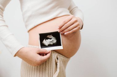 Hamileyken karnında doğmamış bebeğin ultrason resmi var. Mutlu anne sonogramdan sonra cenin ultrason görüntüsü gösterir.