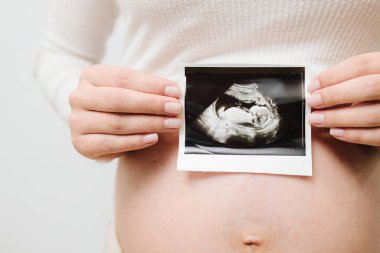Hamile bir kadın karnında bebeğinin ultrason fotoğrafını taşıyor. Anneliğin değerli anlarını ultrasonla filme alıyorum.