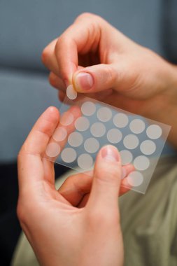 Sivilce ve rosacea tedavisi için kozmetik sivilce bantları. Ellerin kapalı olması cilt tedavisi için sivilce bantları tutar