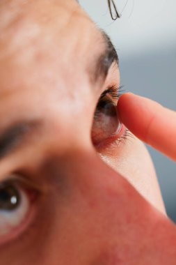 Adam görüş düzeltmesi için günlük kontakt lens takıyor. Göz teması lensleriyle görme düzeltmesi, göz doktoru tarafından seçildi.