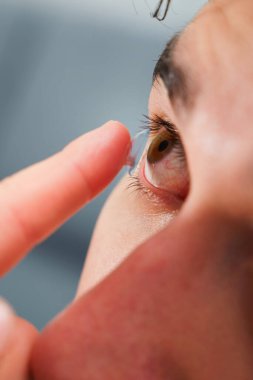 Adam miyop tedavisi için gözüne kontak lens takıyor. Optik kontakt lenslerle göz sağlığının düzeltilmesi