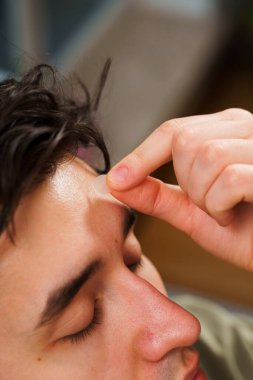 Genç adam sivilceleri temizlemek için alnına sivilce bandı yapıştırıyor. Yüz bakımı için sivilce bandı kullanılıyor
