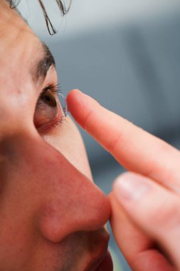 Adam görüş düzeltmesi için günlük kontakt lens takıyor. Göz teması lensleriyle görme düzeltmesi, göz doktoru tarafından seçildi.