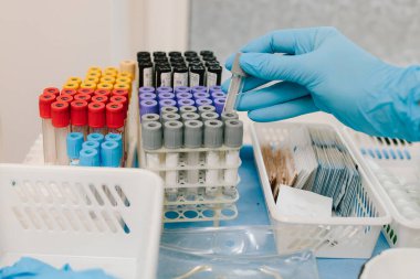 Hastalık kontrolü için hamile hastalarda kan örnekleri alıyorum. Jinekolog jinekoloji kliniğinde laboratuvar testleri için kan toplama tüpleri tutuyor.