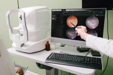 Göz sağlığı için retina taraması, optik sinir değerlendirmesi ve göz doktorunda erken teşhis. Oftalmolog ekrandaki retina görüntülerini inceleyerek glokom ve maküler dejenerasyon teşhisi koydu.