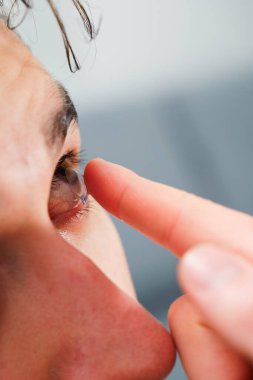 Adam görüş düzeltmesi için günlük kontakt lens takıyor. Göz teması lensleriyle görme düzeltmesi, göz doktoru tarafından seçildi.
