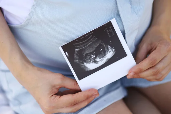 Kobieta Ciąży Usg Rentgen — Zdjęcie stockowe