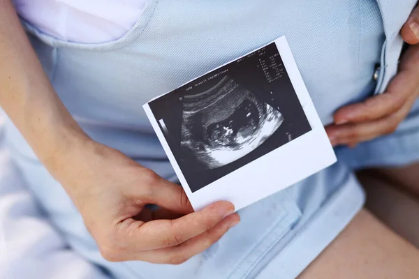 Kobieta Ciąży Usg Rentgen — Zdjęcie stockowe