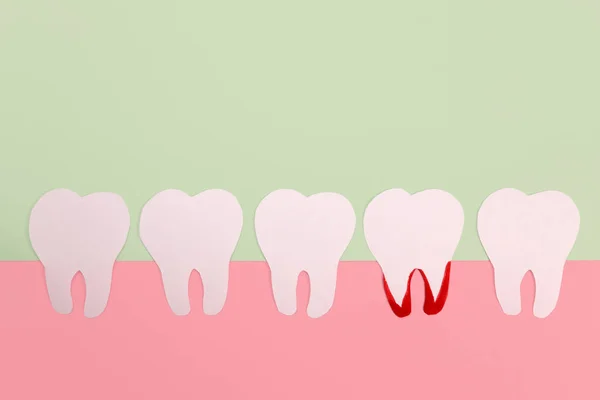 Dentes Papel Com Inflamação Radicular Conceito Cuidados Dentários Serviços Odontológicos — Fotografia de Stock