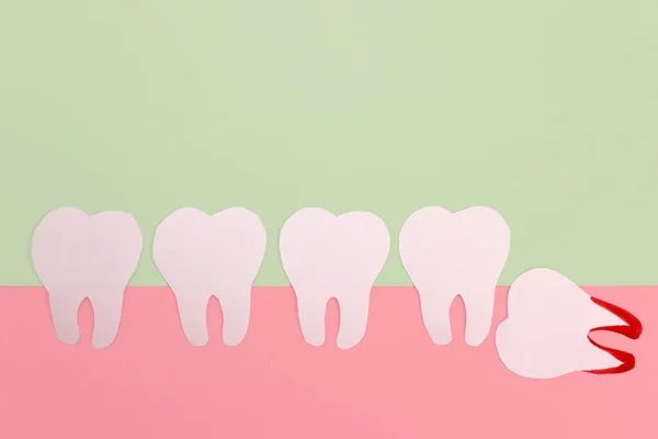 Yatay Yirmilik Dişi Kağıt Modeli Diş Hekimi Cerrah Diş Çıkarma — Stok fotoğraf
