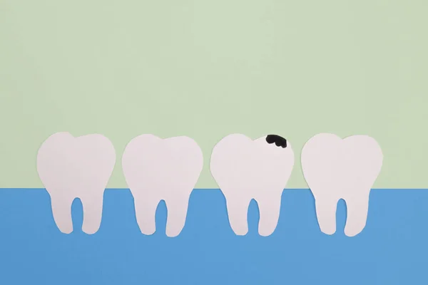 Стоматология Бумажных Зубов Кариесом Концепция Стоматологических Проблем Инфекции Полости Рта — стоковое фото