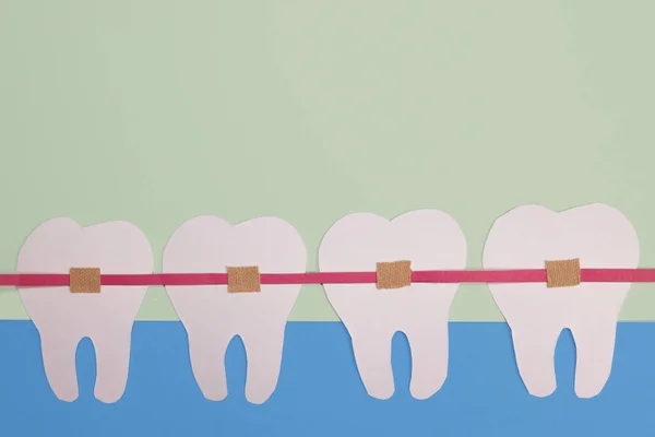 Dentes Papel Branco Aparelho Dentário — Fotografia de Stock