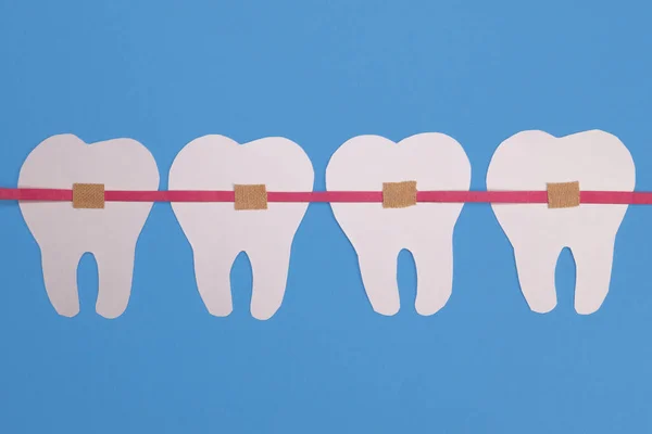 Białe Papierowe Zęby Aparacie Dentystycznym Niebieskim Tle — Zdjęcie stockowe