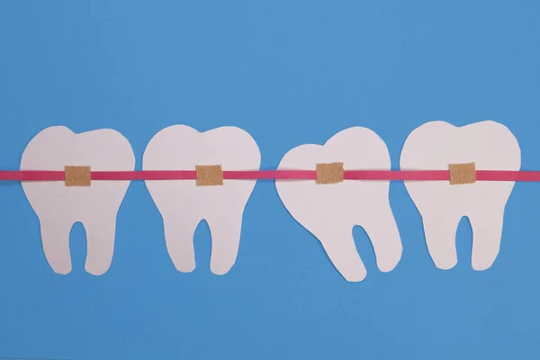 Cintas Sobre Dentes Papel Conceito Alinhamento Dos Dentes Tratamento Odontológico — Fotografia de Stock