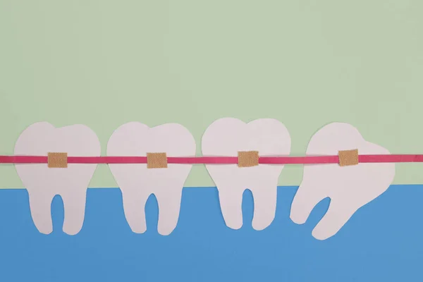 Szelki Papierowych Zębach Koncepcja Osiowania Zębów Leczenie Stomatologiczne Profesjonalnego Stomatologa — Zdjęcie stockowe