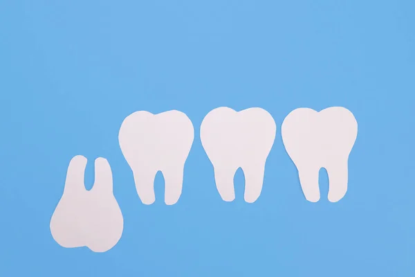 Inverted Problematic Wisdom Tooth Made Paper Blue Background — Stock Photo, Image