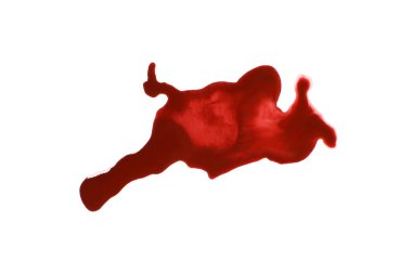 Beyazda izole edilmiş kan birikintisi. Mesleki yaralanma kavramı