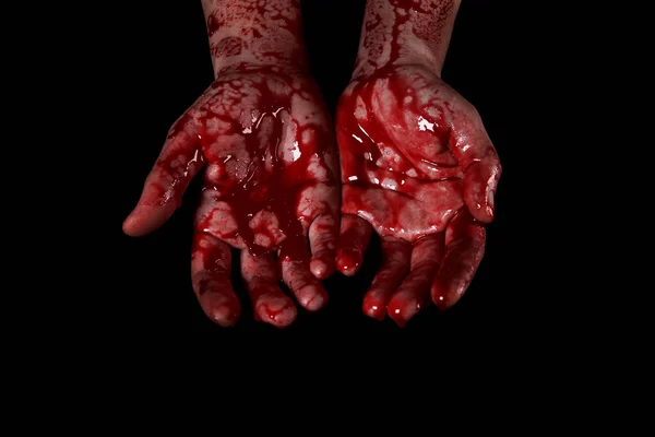 Bloedige Handen Een Zwarte Achtergrond Het Concept Van Zelfverdediging Moord — Stockfoto