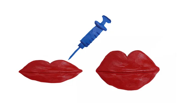 Πλαστικά Χείλη Σύριγγα Ένεση Υαλουρονικού Οξέος Botox Concept — Φωτογραφία Αρχείου