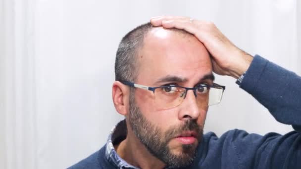 Young Man Alopecia Looking His Head Hair Mirror — Stockvideo