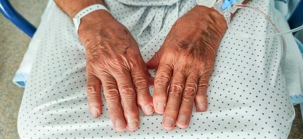 Elderly hands with osteoarthritis and venous catheter in the hospital