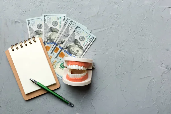 Flat lay composition with educational dental typodont model and money with notebook on colored table, top view. Expensive treatment.