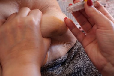 Kadın karnına şırınga ile hormon enjekte ediyor. Tüp bebek konsepti kapat.