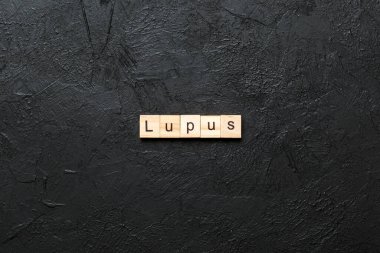 Lupus kelimesi tahta blokta yazılı. Masada lupus metni, konsept.