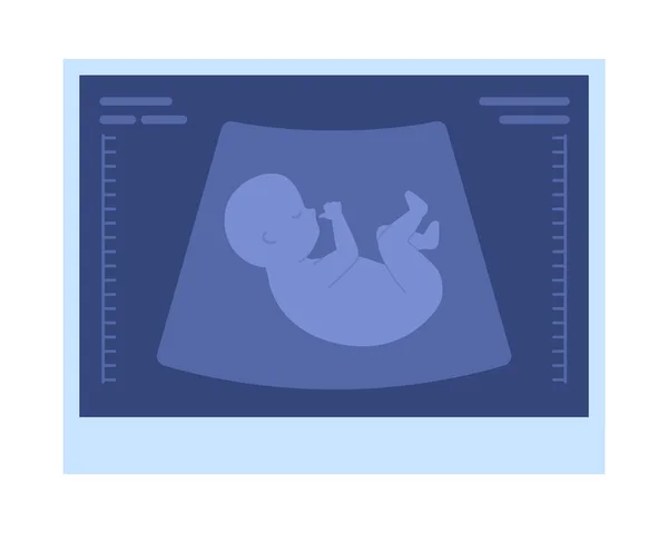 Fetales Ultraschallbild Semi Flaches Farbvektorobjekt Fortschritte Der Schwangerschaft Editierbares Symbol — Stockvektor