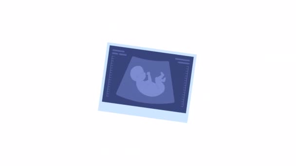 动画超声图像 声像图照片第一次怀孕公告 平面卡通风格图标4K视频镜头 具有Alpha通道透明度的白色背景上的彩色隔离对象动画 — 图库视频影像
