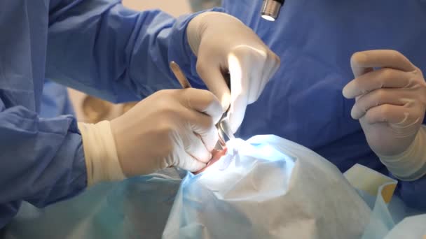 Два Профессиональных Хирурга Проводят Пластическую Операцию Носа Операционной Ринопластику Крупный — стоковое видео