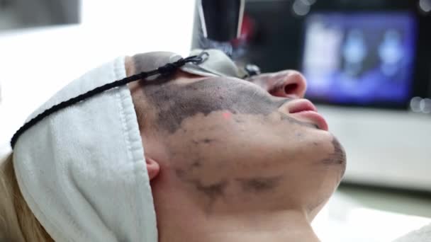 Skicklig Kosmetolog Utför Kolfiberbaserad Hud Peeling Behandling Kosmetologen Administrerar Kolytan — Stockvideo