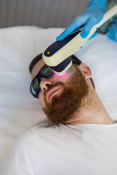 Permanent laser hair removal of the beard contour. Male undergoing painless laser treatment for facial hair removal at a beauty salon. Doctor in gloves conducts procedure at clinic