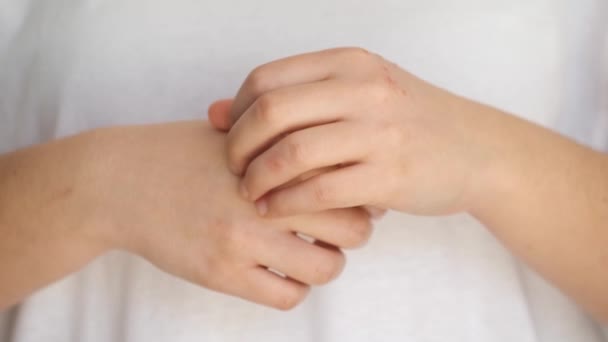 Μια Γυναίκα Ξύνει Έκζεμα Στο Χέρι Της Δερματίτιδα Αλλεργία Ψωρίαση — Αρχείο Βίντεο