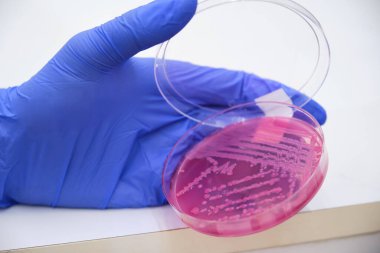Pembe bir petri kabında bakteri kültürü tutan eldivenli bilimsel bir el. Bilimsel araştırma.