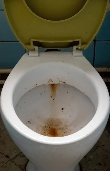 Старый Открытый Засорившийся Туалет Затерянном Месте — стоковое фото