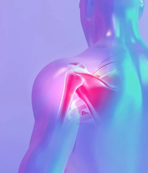 イラスト 肩痛いスケルトン 線医療コンセプト ロイヤリティフリーのストック画像