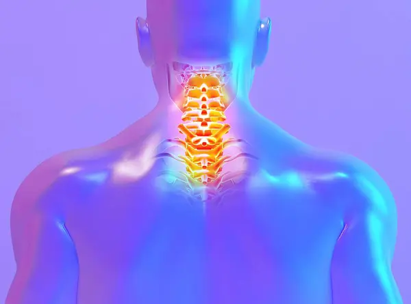 イラスト 首の痛みを伴うスケルトン 医療コンセプト ロイヤリティフリーのストック画像