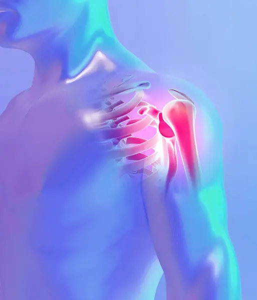イラスト 肩痛いスケルトン 線医療コンセプト ロイヤリティフリーのストック写真