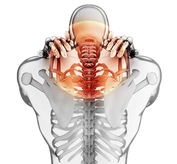 イラストレーション 首の痛み 頚椎骨格の 医療コンセプト ロイヤリティフリーのストック画像