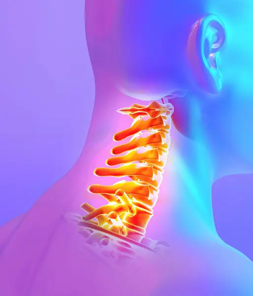 Ilustración Radiografía Del Esqueleto Doloroso Del Cuello Concepto Médico Fotos De Stock
