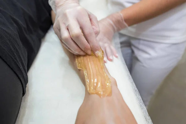 stock image Sugar paste hair removal procedure - shugaring. Cosmetologist applies sugar paste to the hand of a young woman.Depilation of female hands in a beauty parlor.