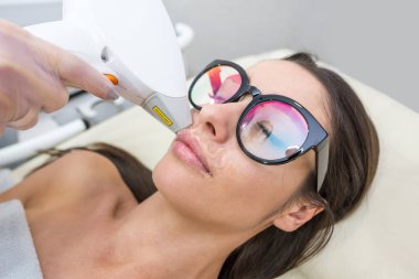 Yüzünde istenmeyen bir lazer çıkarıcı saç var genç bayan. Sağlık ve güzellik konsepti. Genç bir kadın kuaförde yüzüne lazer tedavisi yaptırıyor.