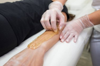 Şeker macunu tüy yolma prosedürü - karıştırma. Kozmetik uzmanı genç bir kadının eline şeker yapıştırıcısı sürüyor. Kadın elinin güzellik salonunda dezenfekte edilmesi..