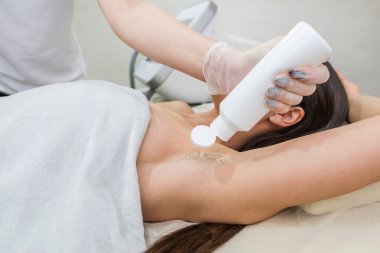 Kozmetik uzmanı koltukaltı derisine şeffaf özel bir jel uyguluyor. Koltuk altlarının derisi için jöleyi hazırlama aşaması lazer tüyü almak için..