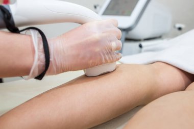 Bacaklarda saç kesimi, klinikte lazer prosedürü. Güzellik salonunda güzel, pürüzsüz kadın bacakları, spa konsepti. Lazer cilt bakım pankartı